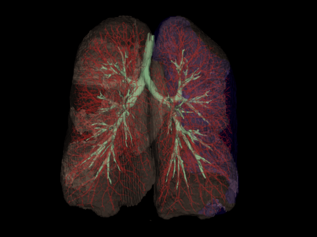 Lungs