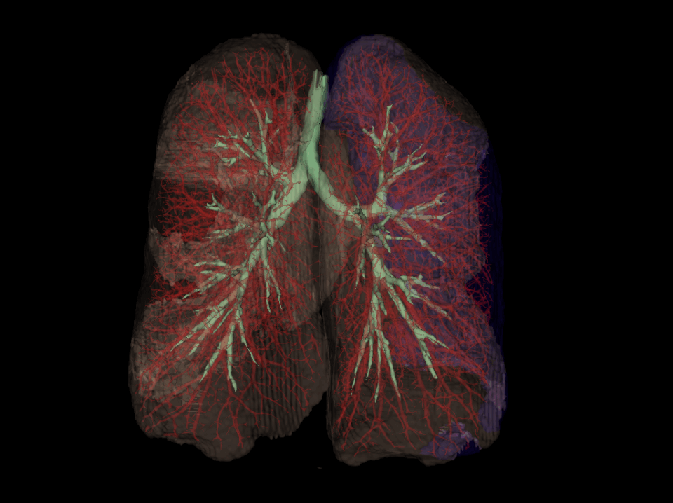 Lungs